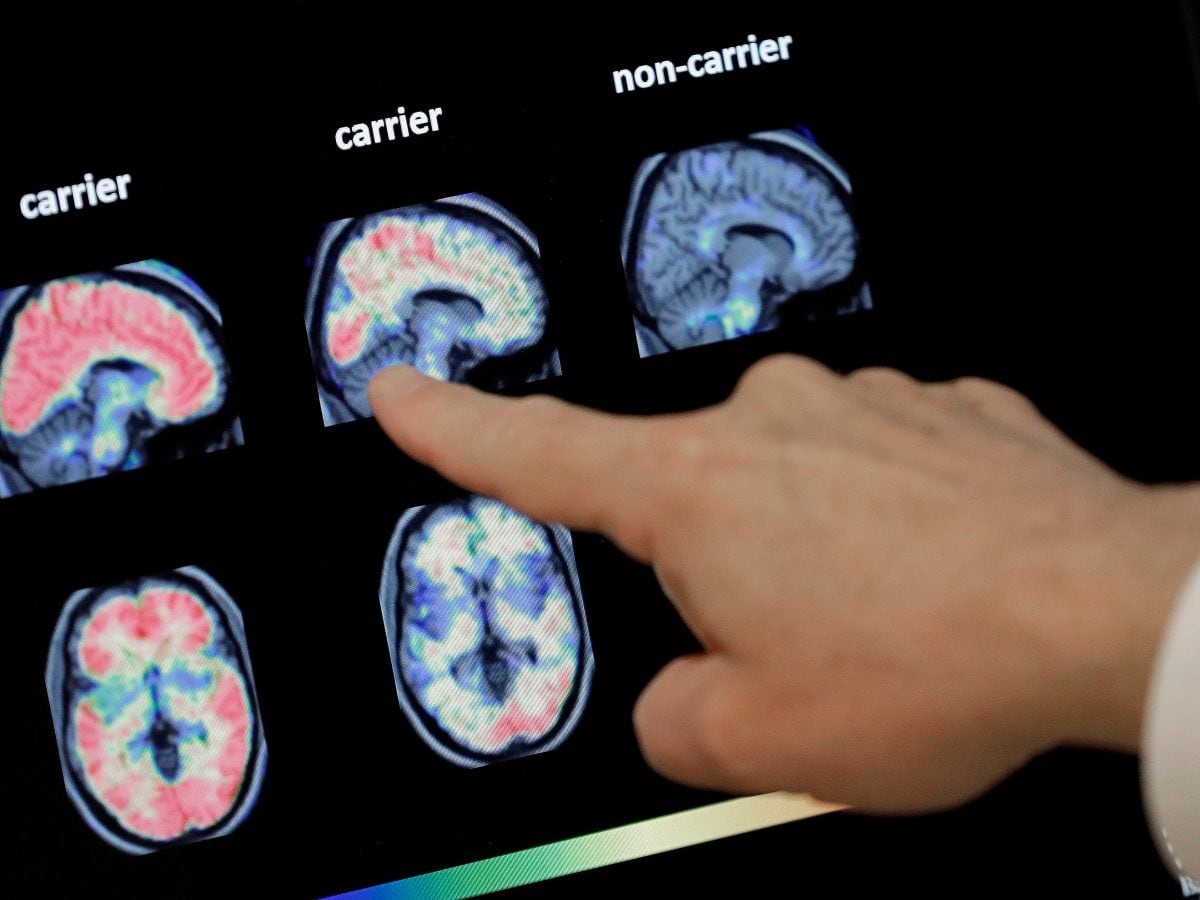 19 Dead in Kerala From ‘Brain-Eating Amoeba’: What You Must Know