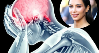 What Is a Brain Aneurysm? Causes, Symptoms, Treatment & Kim Kardashian Diagnosed Story| Details Inside