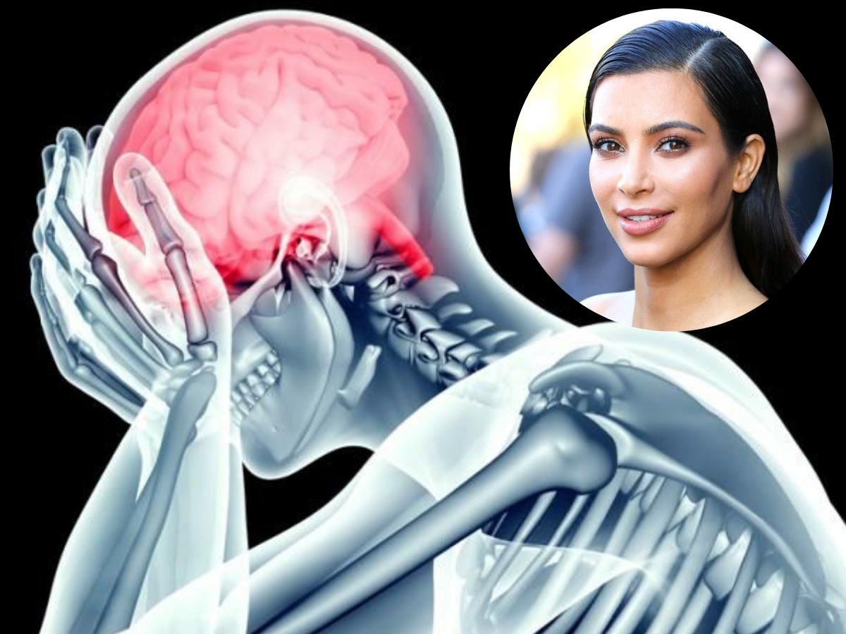 What Is a Brain Aneurysm? Causes, Symptoms, Treatment & Kim Kardashian Diagnosed Story| Details Inside