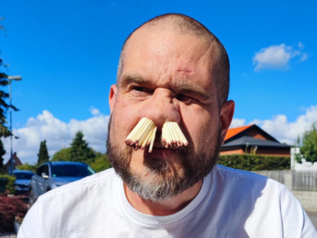 A Nose for Records: Swedish Dad Fits 81 Matches in His Nose