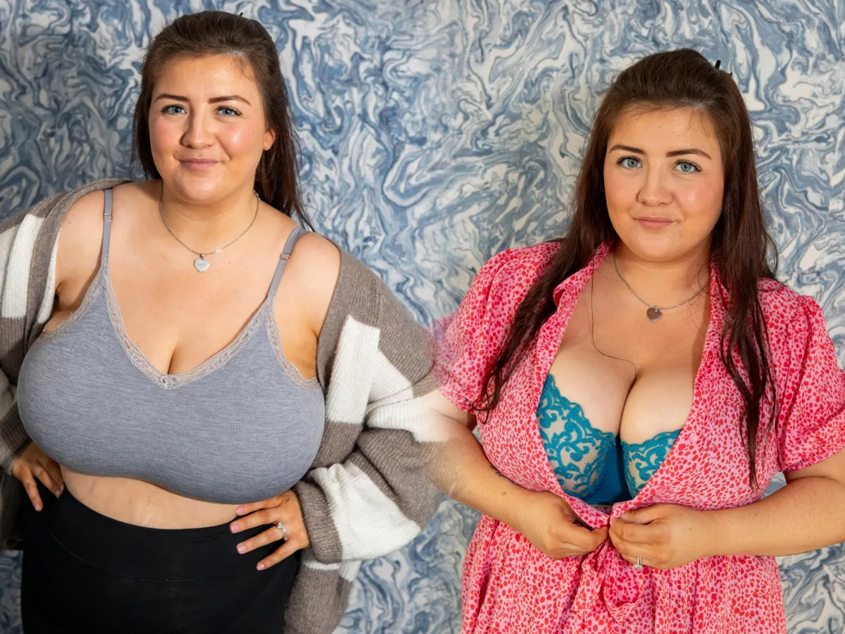 UK Mum 36M Boobs Weigh 2.5 Stone — Now She’s Begging the Public to Help Fund a Reduction