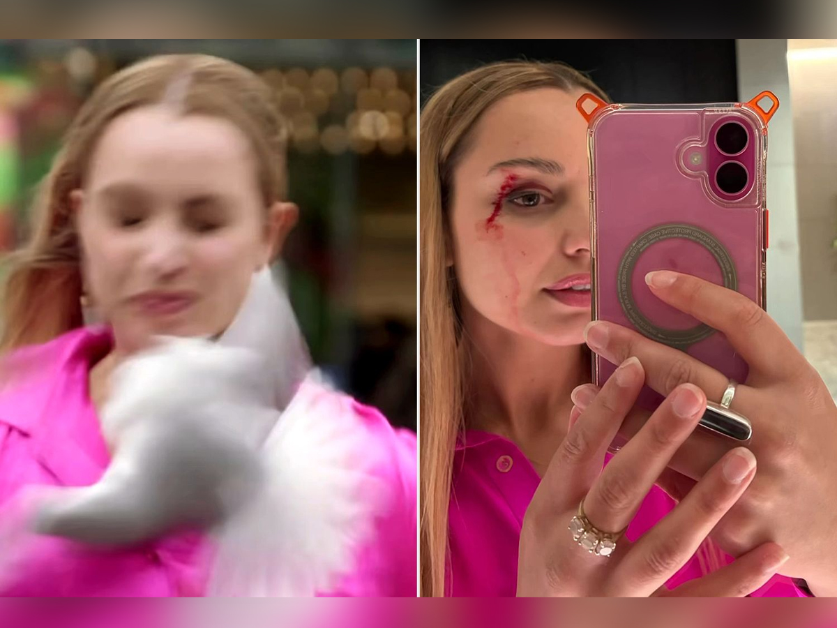 New Zealand Journalist Bleeds After Seagull Flies Into Her Face on Set | Watch Viral Video