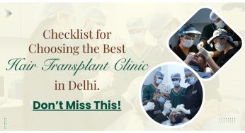 How to Choose the Best Hair Transplant Clinic in Delhi, India?