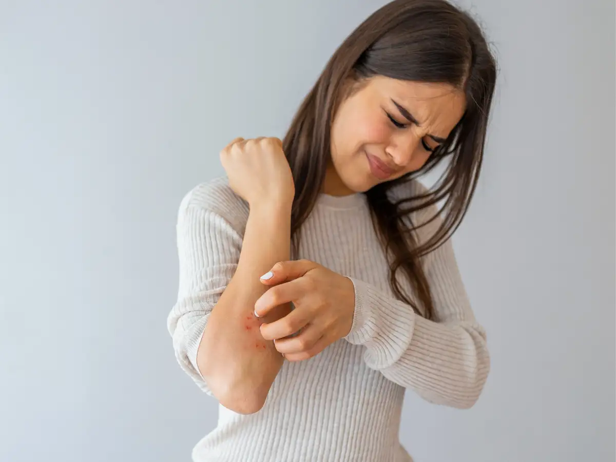 Don’t Ignore Post-Holi Skin Reactions: Expert Advice for Quick Recovery