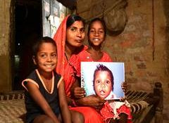 On World Cleft Awareness Day, Smile Train India Marks 800,000+ Free Surgeries and a Renewed Push for Early Diagnosis of Clefts