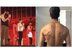 KKK 15: After Gaurav Khanna, Karan Wahi shares injury marks from 'rubber bullet' challenge, calls season "scariest"